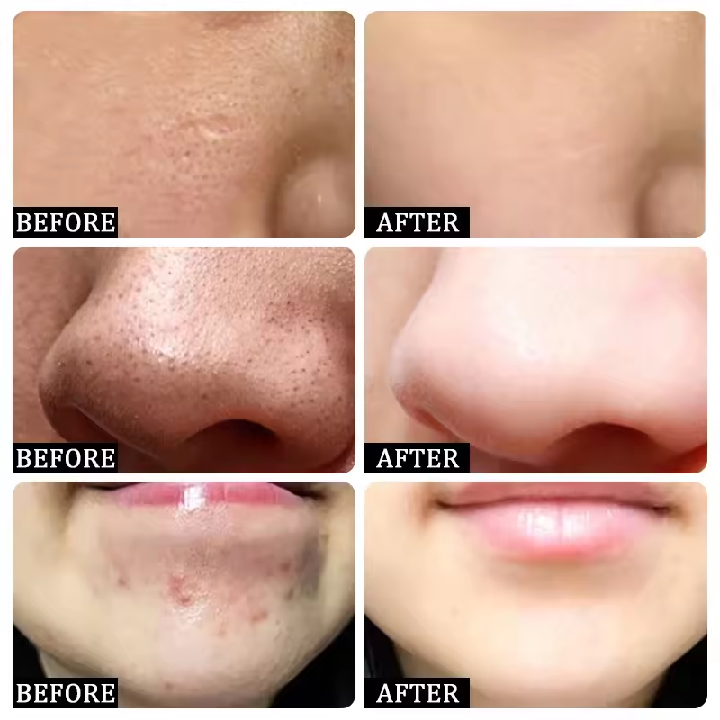 Pore Shrinking Cream Eliminati - огляд і ціна Korean Skincare Routine