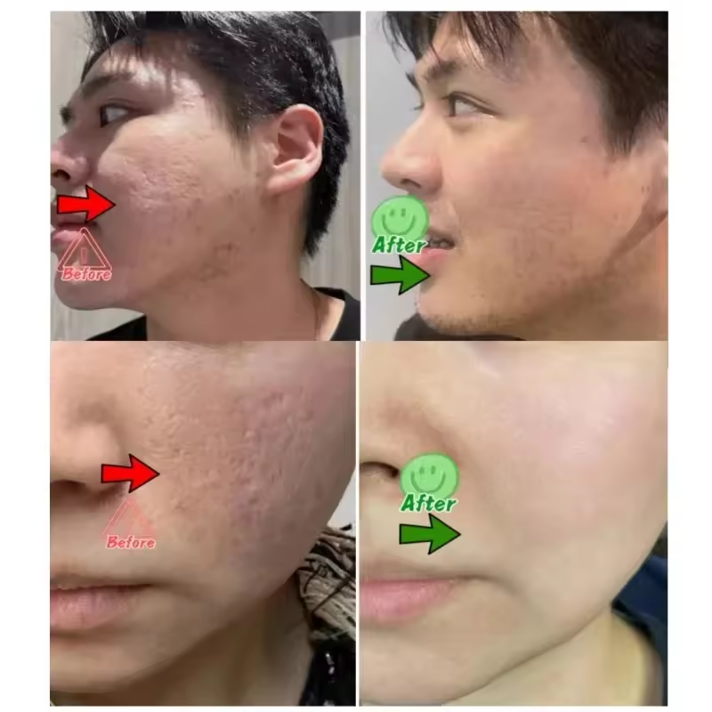 Pore Shrinking Cream Eliminati - огляд і ціна Korean Skincare Routine