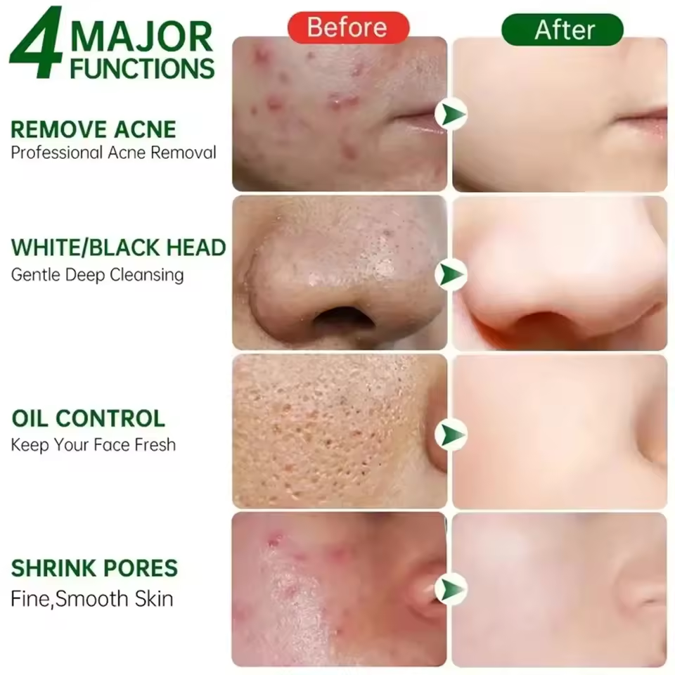 Pore Shrinking Cream Eliminati - огляд і ціна Korean Skincare Routine